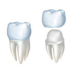 dental crown restoration bala cynwyd pa dentist
