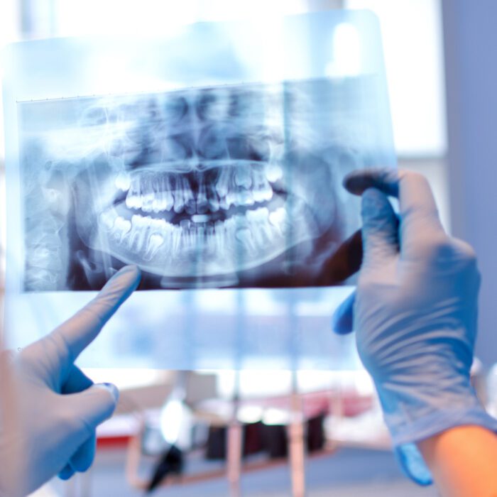 general dentistry routine dental exam at a bala cynwyd pa family dentist