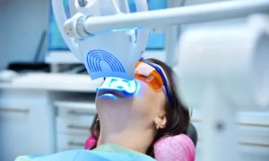 Why Choose Professional Teeth Whitening in Philadelphia, PA